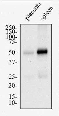 Western Blot: MHC Class II RT1B Antibody (OX-6)BSA Free [NB100-65541]