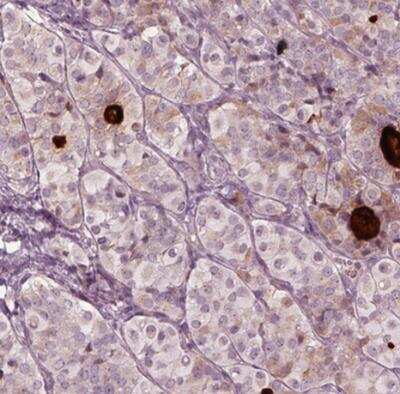 Immunohistochemistry-Paraffin: MIA Antibody [NBP2-34846]