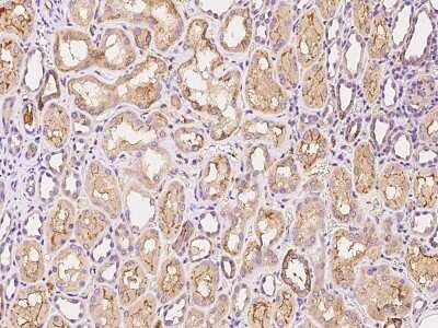 Immunohistochemistry-Paraffin: MIA Antibody [NBP2-99450]