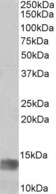 Western Blot: MIA Antibody [NBP2-26185]