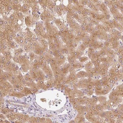 Immunohistochemistry-Paraffin: MIA2 Antibody [NBP2-33704]