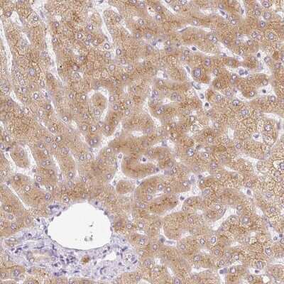 Immunohistochemistry-Paraffin: MIA2 Antibody [NBP2-33754]