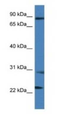 Western Blot: MIA2 Antibody [NBP1-74078]