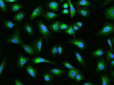 Immunocytochemistry/ Immunofluorescence: MIA3 Antibody [NBP2-98635]