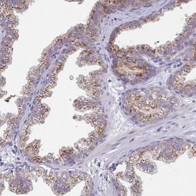 Immunohistochemistry-Paraffin: MIA3 Antibody [NBP2-33770]
