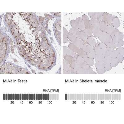 Immunohistochemistry-Paraffin: MIA3 Antibody [NBP2-33770]