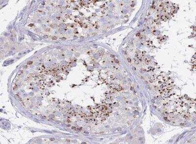 Immunohistochemistry-Paraffin: MIA3 Antibody [NBP2-34160]