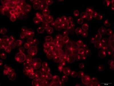 Immunocytochemistry/ Immunofluorescence: MICA Antibody - BSA Free [NBP1-76805]