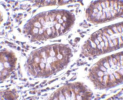 Immunohistochemistry-Paraffin: MICA Antibody - BSA Free [NBP1-76805]
