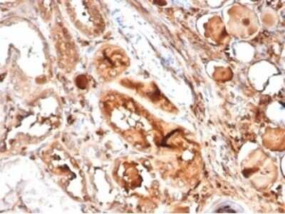 Immunohistochemistry-Paraffin: MICA Antibody (MICA/4442) [NBP3-13826]