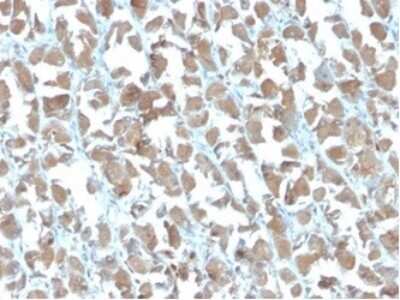 Immunohistochemistry-Paraffin: MICA Antibody (MICA/4442) [NBP3-13826]