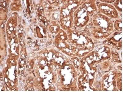 Immunohistochemistry-Paraffin: MICA Antibody (MICA/4443) [NBP3-13827]