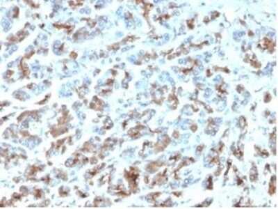 Immunohistochemistry-Paraffin: MICA Antibody (MICA/4443) [NBP3-13827]