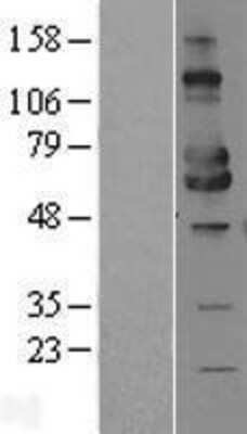 Western Blot: MICA Overexpression Lysate [NBL1-13098]