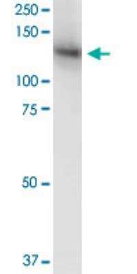 Western Blot: MICAL1 Antibody (3D12) [H00064780-M06-100ug]