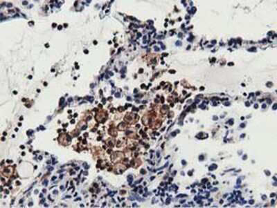 Immunohistochemistry-Paraffin: MICAL1 Antibody (OTI6H4) [NBP2-03135]
