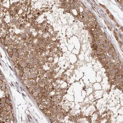 Immunohistochemistry-Paraffin: MICAL2 Antibody [NBP1-81483]