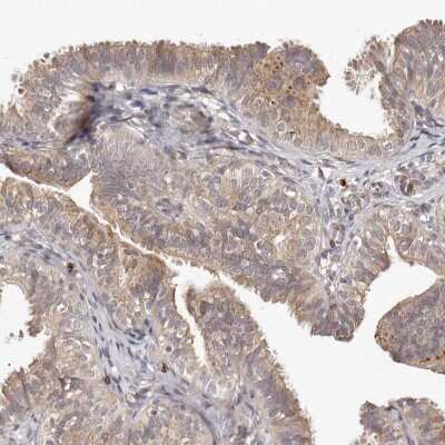 Immunohistochemistry-Paraffin: MICAL2 Antibody [NBP1-81483]