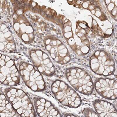 Immunohistochemistry-Paraffin: MICAL2 Antibody [NBP1-81483]