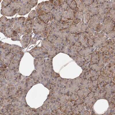 Immunohistochemistry-Paraffin: MICAL2 Antibody [NBP1-81483]
