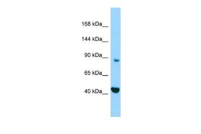 Western Blot: MICAL2 Antibody [NBP2-83205]