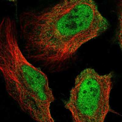 Immunocytochemistry/ Immunofluorescence: MICAL3 Antibody [NBP2-56826]