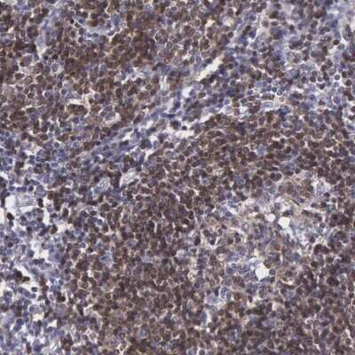 Immunohistochemistry-Paraffin: MICAL3 Antibody [NBP2-47373]