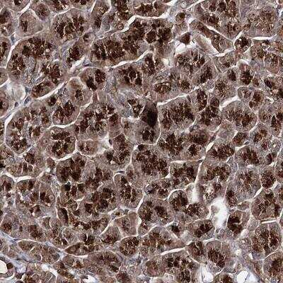 Immunohistochemistry: MICALCL Antibody [NBP1-94001]