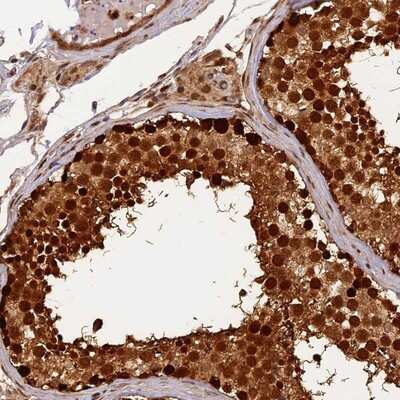 Immunohistochemistry-Paraffin: MICALL1 Antibody [NBP1-81386]