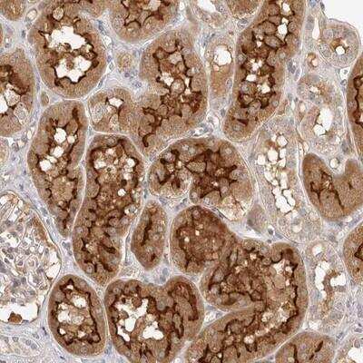Immunohistochemistry: MICALL2 Antibody [NBP1-82073]