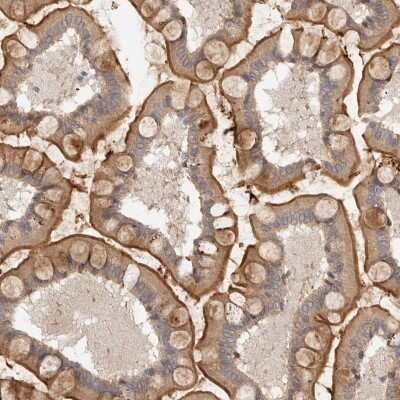Immunohistochemistry-Paraffin: MICALL2 Antibody [NBP1-82073]