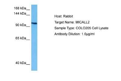 Western Blot: MICALL2 Antibody [NBP2-83208]