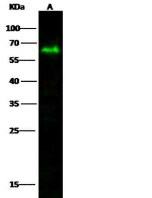 Western Blot: MICB Antibody (102) [NBP2-89627]