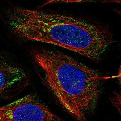 Immunocytochemistry/ Immunofluorescence: MICB Antibody [NBP2-56506]