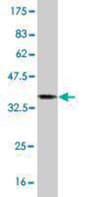 Western Blot: MID1 Antibody (2C11) [H00004281-M06]