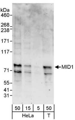 Western Blot: MID1 Antibody [NBP1-26612]