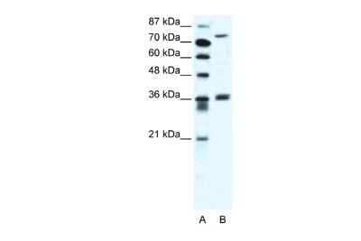 Western Blot: MID1 Antibody [NBP2-86706]