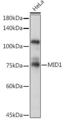 Western Blot: MID1 AntibodyBSA Free [NBP3-05061]