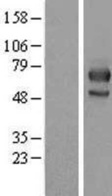 Western Blot: MID1 Overexpression Lysate [NBL1-13102]