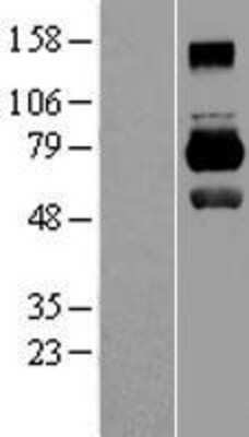 Western Blot: MID1 Overexpression Lysate [NBL1-13103]