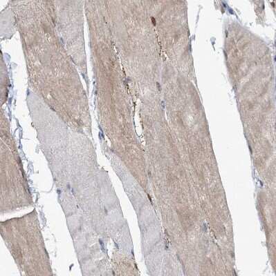 Immunohistochemistry-Paraffin: MID1IP1 Antibody [NBP1-84629]