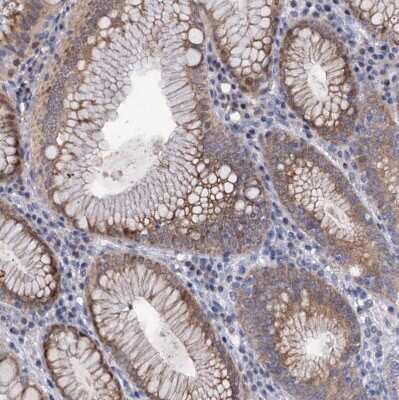 Immunohistochemistry-Paraffin: MID1IP1 Antibody [NBP1-84629]