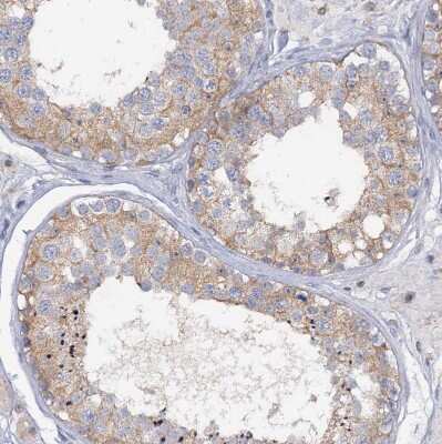 Immunohistochemistry-Paraffin: MID1IP1 Antibody [NBP1-84629]