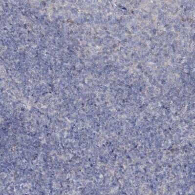 Immunohistochemistry-Paraffin: MID1IP1 Antibody [NBP1-84629]