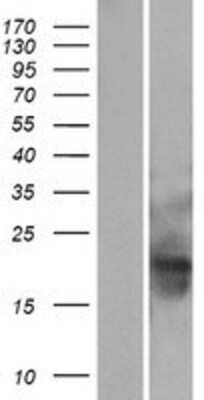 Western Blot: MID1IP1 Overexpression Lysate [NBL1-13104]