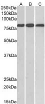 Western Blot: MID2 Antibody [NB100-1167]