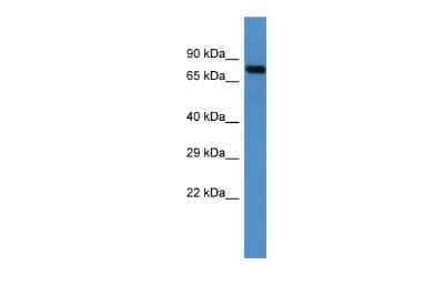 Western Blot: MID2 Antibody [NBP2-82286]