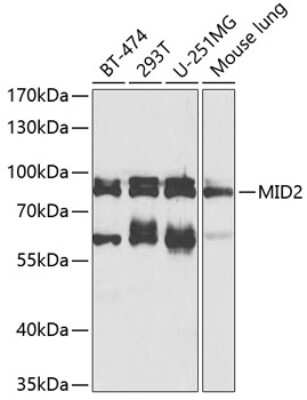 Western Blot: MID2 AntibodyBSA Free [NBP3-05060]