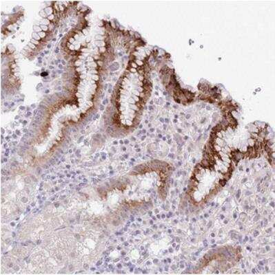 Immunohistochemistry: MIDN Antibody [NBP2-30437]
