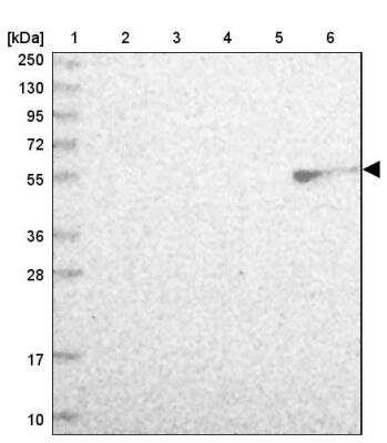 Western Blot: MIDN Antibody [NBP2-30387]